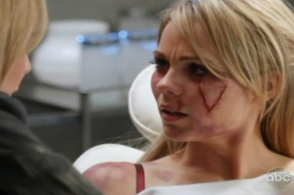 sonya smith scar v scar inflicted on lisa's Henrickson was in School A 